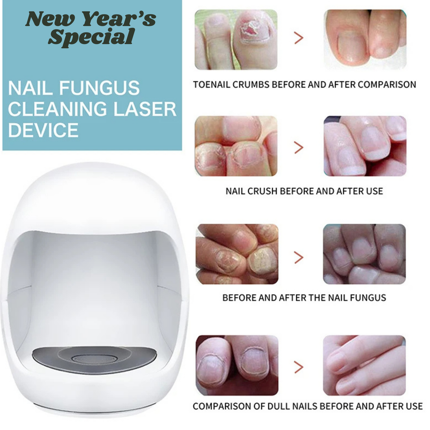 Nail Reviver Ultimate Nail Care Device